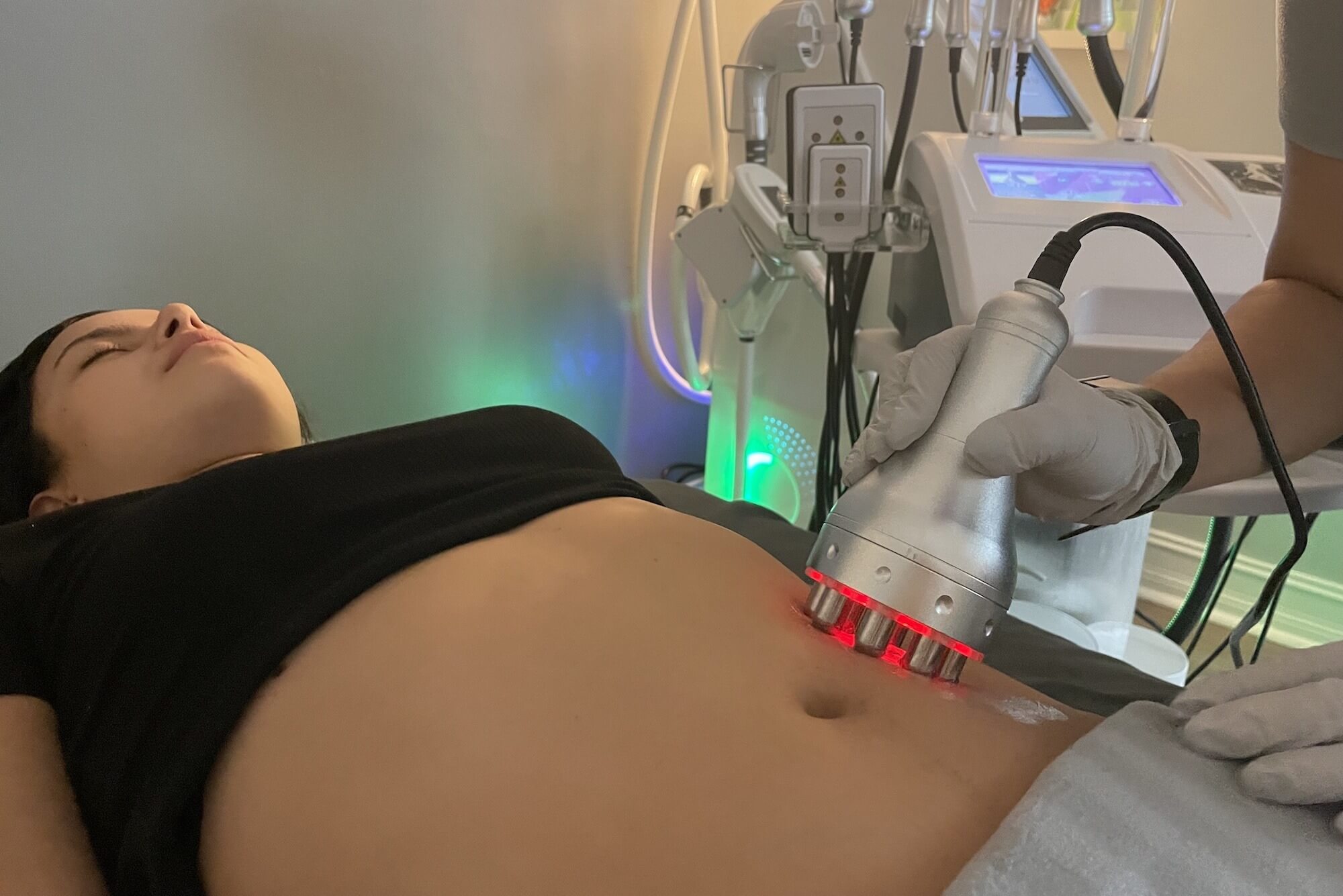 Radiofrequency